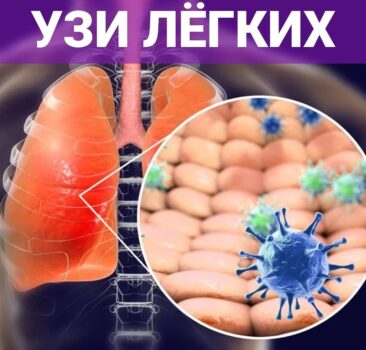 узи ковид ава